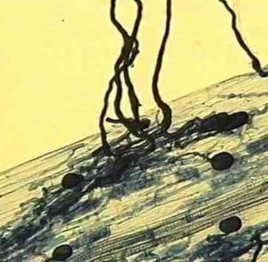Mycorrhizal fungi